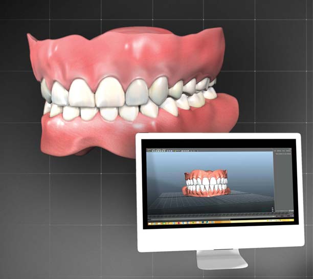 Introducing a Digital Denture Workflow Into Daily Practice eBook Thumbnail