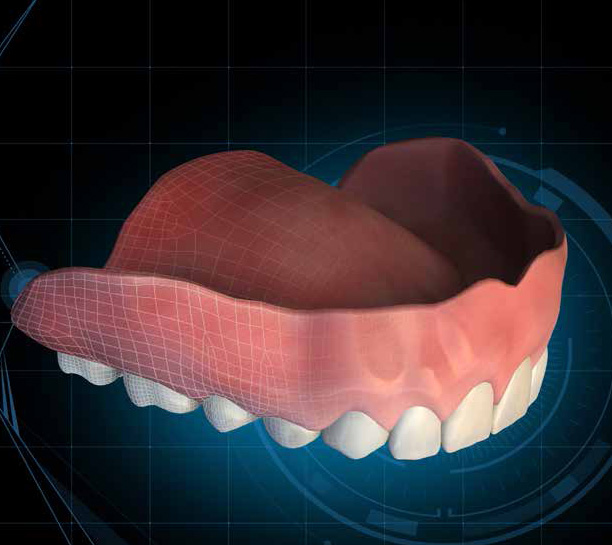 Streamlining and Simplifying Denture Fabrication with Digital Processes eBook Thumbnail