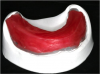 Figure 17. Finished wax bite rim.