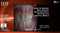 Back to Basics: Why Analog Dentures Still Matter in a Digital World Webinar Thumbnail
