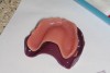Figure 2 The old, worn denture was used to identify which size impression tray was likely to fit best.