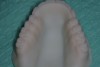 Figure 13 The occlusal surface of the prototype denture.